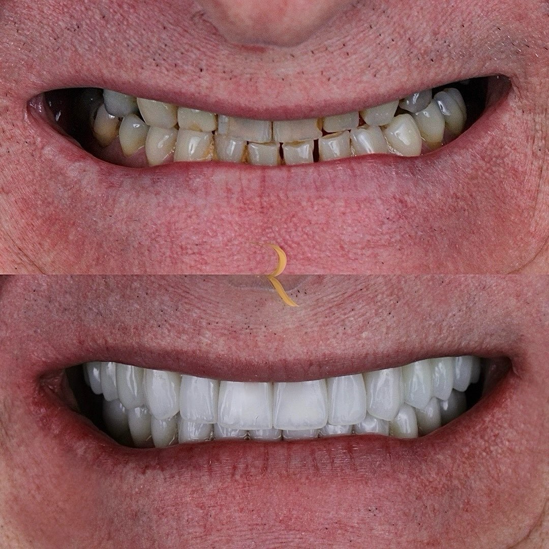 ANTES E DEPOIS 01