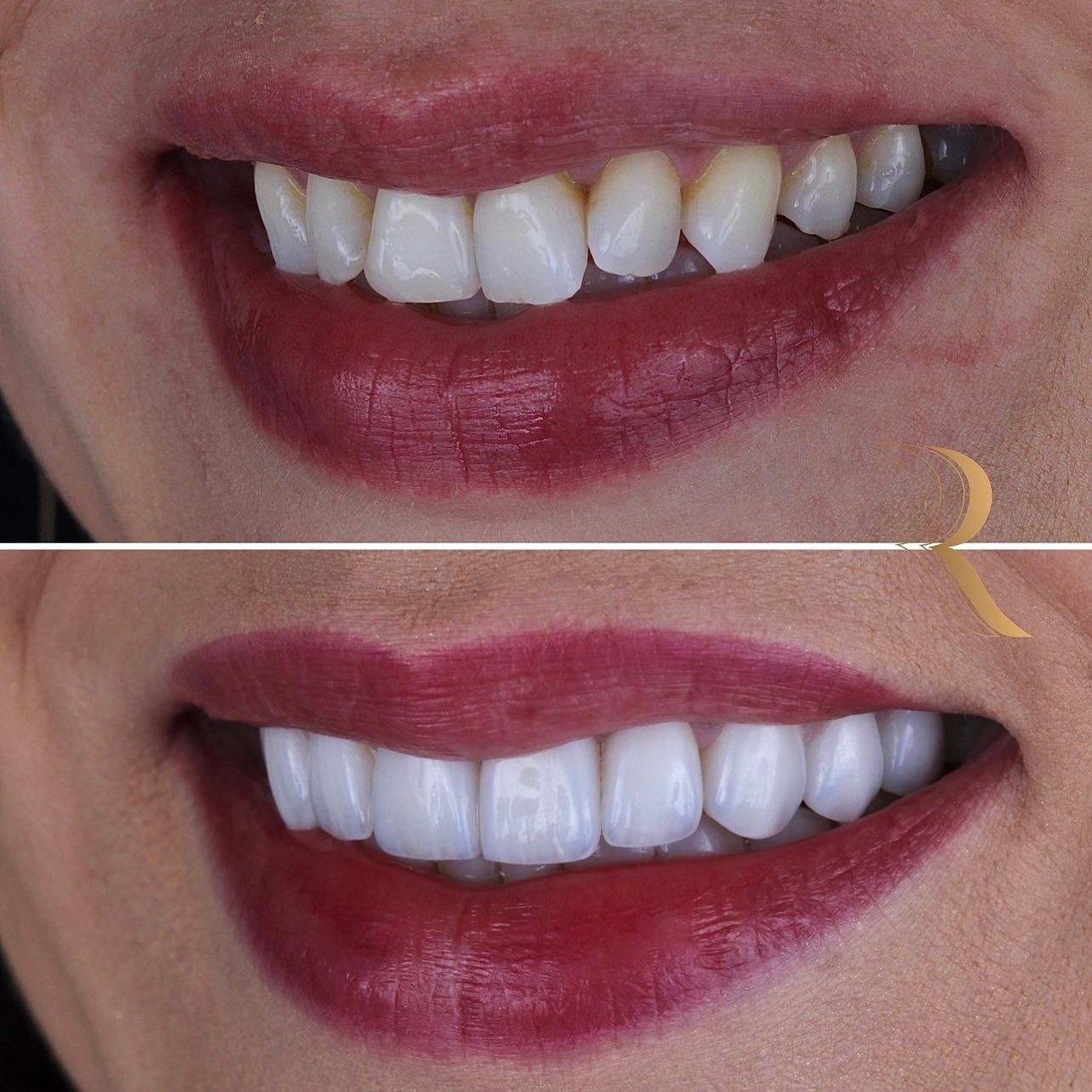 ANTES E DEPOIS 05