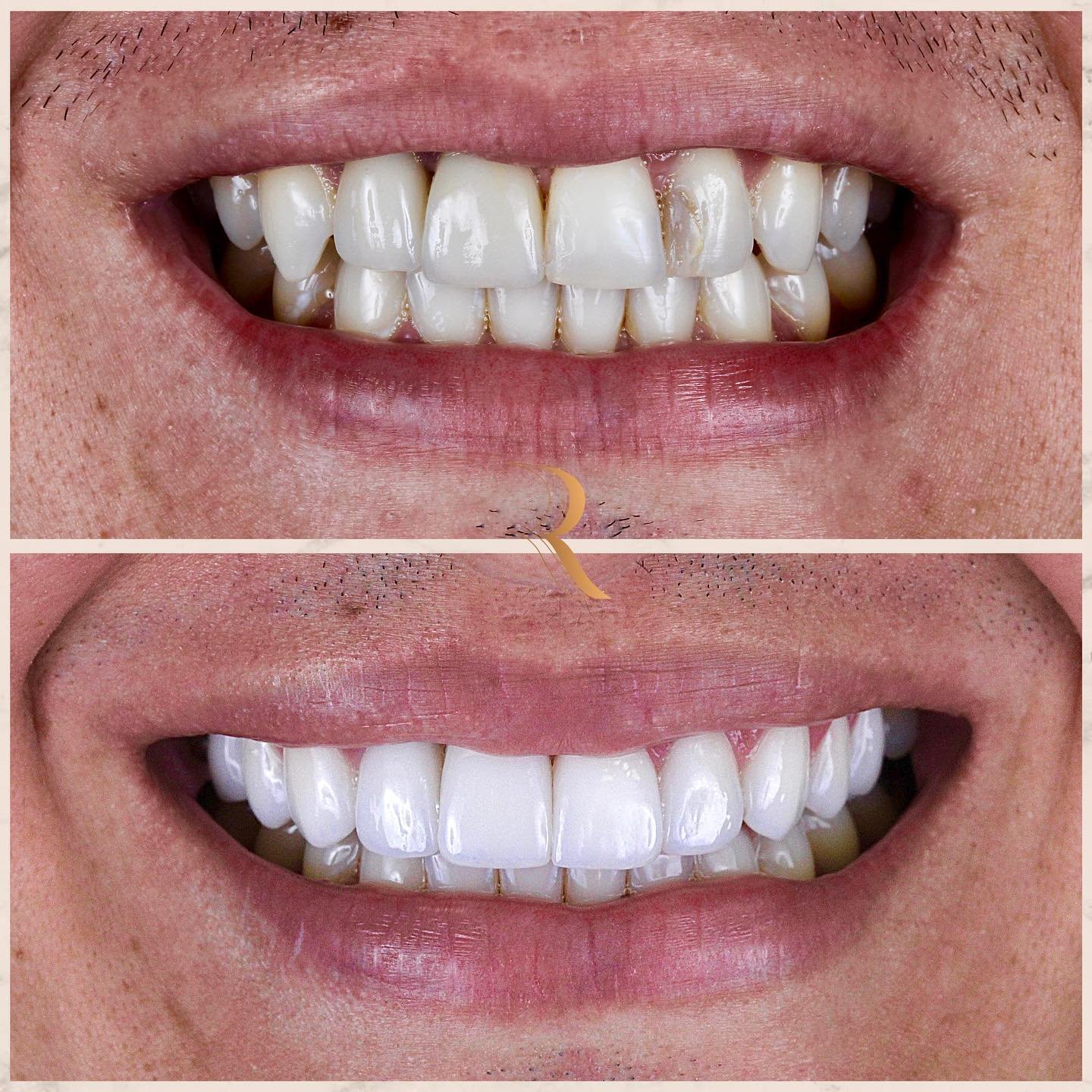 ANTES E DEPOIS 09